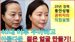 40대 이후 우아하고 고급스러운 아름다운 얼굴 만들기-얼굴지방이식-안면 리프팅-입체 페이스 리모델링