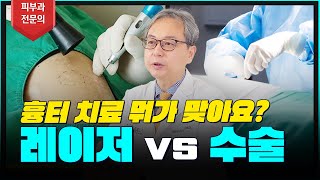 나에게 맞는 흉터 치료방법은 뭘까!? #흉터치료 #흉터 #레이저 #수술