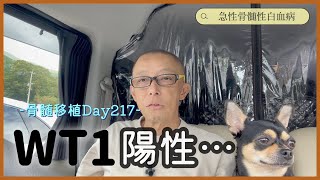 【白血病】残念な結果-Day217-【抗がん剤】