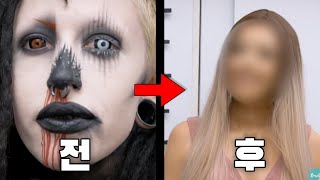 눈알까지 타투한 문신 중독자가 타투를 지우면 벌어지는 일