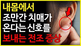 내몸에서 이것이 나타난다면 조만간 치매가 온다는 신호입니다. 이러한 증상이 나타난다면 반드시 미리 예방하는 것이 중요합니다.