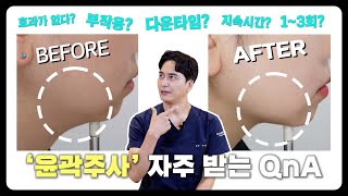 윤곽주사 시술에 대해 자주 받는 질문 QnA 모음 영상 (효과가 없다ㅣ 부작용ㅣ다운타임ㅣ지속시간ㅣ1~3회 시술)