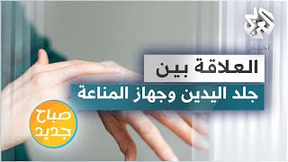 ماهي العلاقة بين حالة جلد اليدين وجهاز المناعة؟