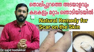 Natural Remedy for Scar on the Skin, തൊലിപ്പുറത്തെ പാടുകൾ മാറ്റാൻ ഫലപ്രദമായ നാച്ചുറൽ മരുന്ന്