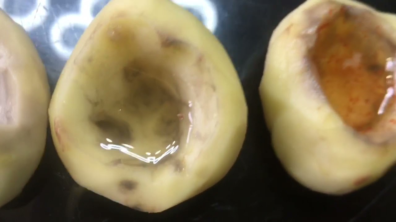 Osmosis In Potatoes - YouTube