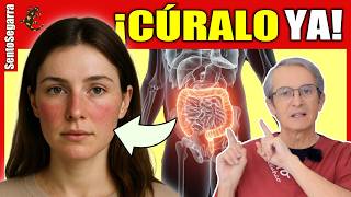 The Skin is a Reflection of Your Intestines (The Dermatologists' Secret)