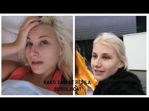 KAKO SAM SE REŠILA BUBULJICA?! - YouTube