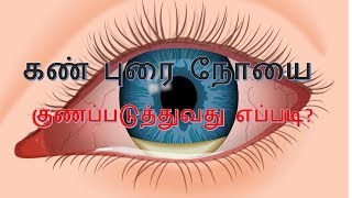 கண் புரை நோயை இயற்கை முறையில் குணப்படுத்துவது எப்படி?HOW TO CURE EYE CATCH