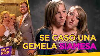 Gemela siamesa se casa y genera curiosidad en Internet: la historia de Abby y Brittany Hensel