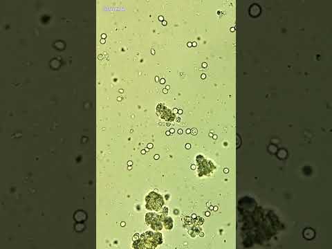 What microbe is used in blue cheese?