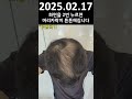 수술없이 탈모관리하는 저만의 모든 경험 노하우 모두 공개할 예정입니다. ep 113 2025.02.17