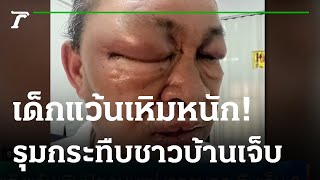 แก๊งแว้นเหิมปิดถนนแข่งรถรุมกระทืบเจ็บ 2 | 19-12-65 | ข่าวเย็นไทยรัฐ