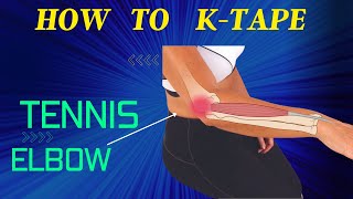 How to apply Kinesiology taping for Lateral epicondylitis - tennis elbow