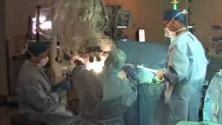 Moyamoya surgery, Gary Steinberg, MD, Packard Children's