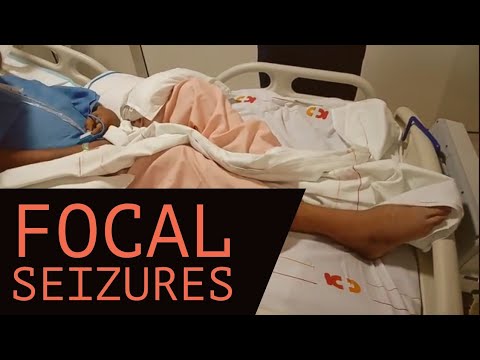 How long can Jacksonian seizures last?