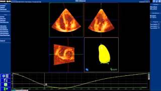 How to use LV quantification software of Q-Lab 9