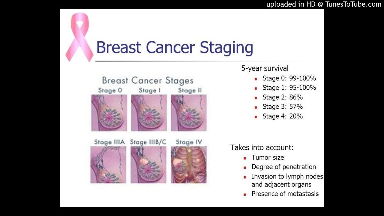 Stage IV Metaplastic Breast Cancer In Which Primary Tumor Was Removed ...