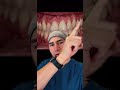 Le querían poner resina para cubrir el cuello de sus dientes. ¡Mala idea! #shorts