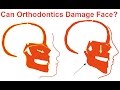 Can Orthodontics Damage Faces by Prof John Mew