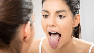 TONGUE DIAGNOSIS MADE EASY: Tongue Inspection