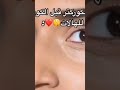 احسن طريقة تتخلصي بيها من الهلات السوداء واي بقعة داكنة في وجهك 😘😘