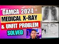 2024 मैं GAMCA medical X-ray unfit problems को कैसे FIT करें | sn creation #sncreation