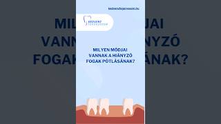 Milyen eljárások léteznek a hiányzó fogak pótlására? #kedvencfogorvosom #fogászat #fogpótlás