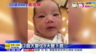 20161010中天新聞　控月子中心疏失　男嬰腋下紅腫脫皮