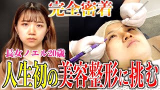 【密着ドキュメント】長女ノエル20歳が人生初の美容整形に挑戦！二重プチ整形・埋没法とは？