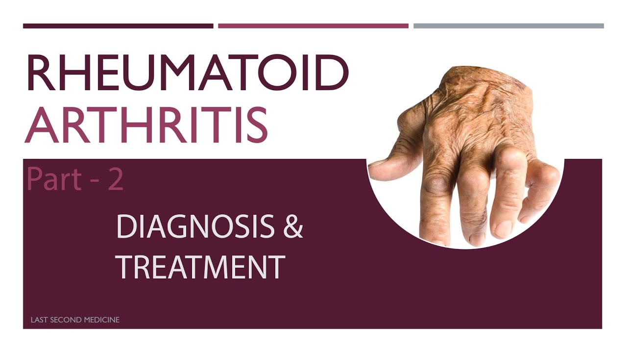 Diagnosis & Treatment Of Rheumatoid Arthritis | Rheumatoid Arthritis ...