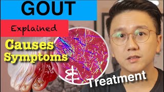 GOUT Symptoms & Treatment & causes | WHAT IS GOUTY ARTHRITIS