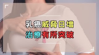 乳癌威脅日增 治療有所突破｜好心肝˙好健康