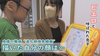 自画像に変化が…５歳で自分の病気を理解し始める「ピエロと呼ばれた息子」第６６話