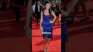 Kardashians/Jenner Before and after plastic surgery #shorts
