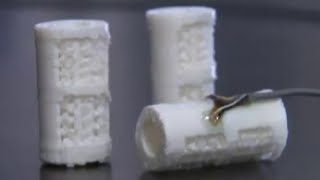 Good Health: 3D printer helping regrow bones