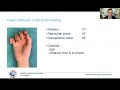 hand fractures in children