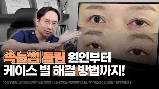 📢속눈썹 들림 원인과 케이스, 그리고 해결 방안까지‼️| 눈성형만 하는 온리아이성형외과