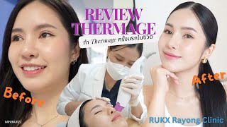 รีวิว ทำThermage ครั้งแรกในชีวิต ที่ Rukx Rayong Clinic | mininuiizz