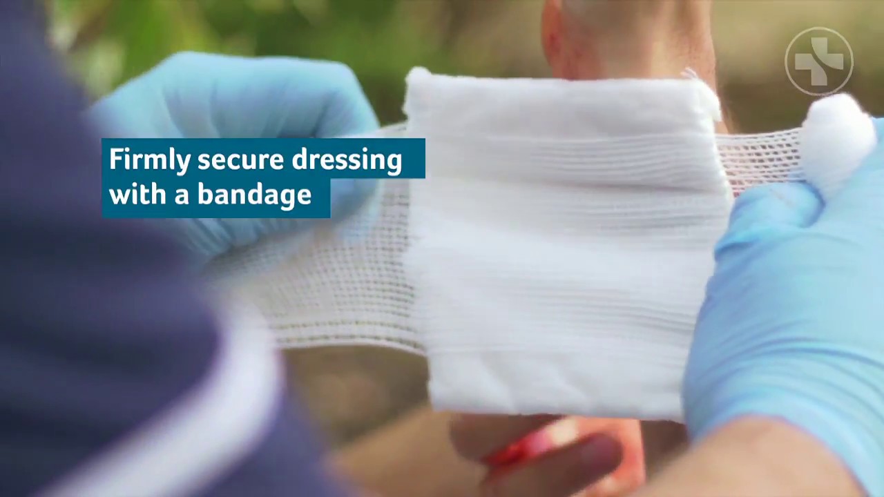 First Aid Skills Severe Bleeds Youtube