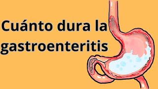 Cuánto dura la gastroenteritis: Tiempo de recuperación y síntomas