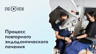 Повторное эндодонтическое лечение: история пациента и процесс лечения