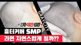 삭발 흉터커버 1차 과연 자연스럽게 될까?? (리얼영상) #smp #두피문신 #그레이시티 #은평구두피문신