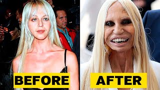 20 Top Celebrity Plastic Surgery Disasters
