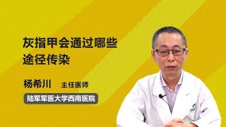 灰指甲会通过哪些途径传染 杨希川 陆军军医大学第一附属医院陆军军医大学西南医院