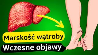 12 Pierwszych Objawów Uszkodzenia Wątroby | Przewodnik po Zdrowiu Wątroby