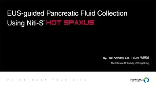 Niti S™ HOT SPAXUS™ STENT | EUS-guided Pancreatic Fluid Collection