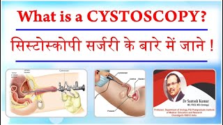 What is a Cystoscopy ? सिस्टोस्कोपी सर्जरी के बारे में जाने | Dr.(Prof)Santosh Kumar PGI.