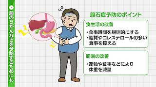 【胆のう結石】食生活などが関係する病気③胆石症に対する負担の少ない治療