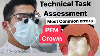 Most Errors when doing your PFM Crown Preparation- ADC Practical Exam