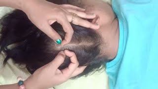 Scalp Searching ASMR (Realistic Tingles)